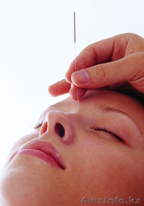 Лечение в Китае #95471