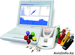 кардиограф ЭКГ,  электрокардиограф 12-ти канальный компьютерный #539327