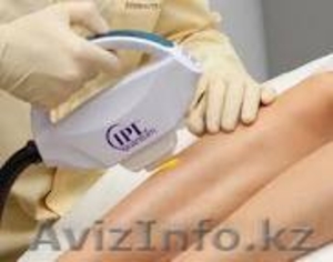 Фотоэпиляция - Удаление волос навсегда!   СКИДКИ #588803