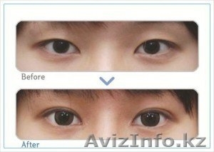 Стажировка для косметологов и врачей в Южной Корее  #808755