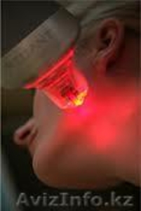  Омоложение лица – RF-лифтинг нового поколения  #865116