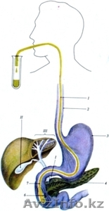  Дуоденальное зондирование #920971