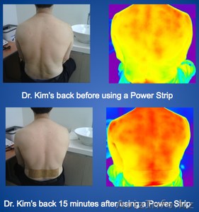 Трансдермальные пластины -быстро снимают боль и убирают причину боли #973160