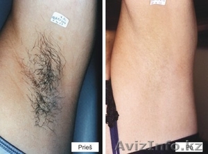 Салоны красоты,  косметология,  #1077587