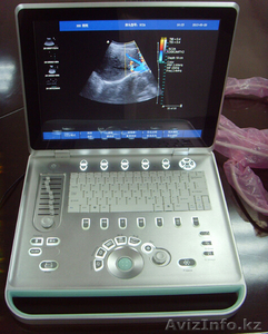 Портативный цветной 3D Допплер ультразвуковой аппарат (УЗИ) С7 #1126278