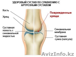 Сыворотка для СУСТАВОВ #1243114