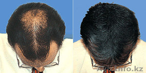 Шампунь больше не понадобится! #1245181