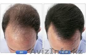 Загуститель волос  #1276409