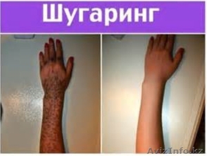 Шугаринг!!!Акция #1318793