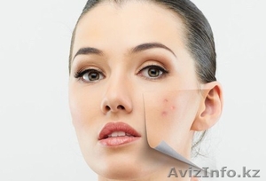 АРАБСКОЕ МЫЛО ОТ ПРЫЩЕЙ VOLCANIC ASH #1322833