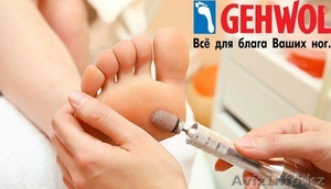 Требуются бесплатно модели!Протезирование,  лечение вросших ногтей #1357584