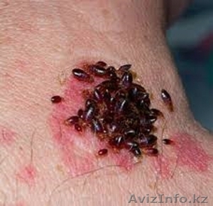 Уничтожение клопов в Алматы. Борьба с клопами. #1397472