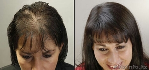 Трихопигментация в Казахстане  #1481932