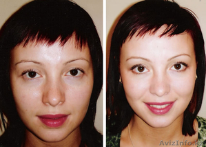 Врач-косметолог с высшим медицинским образованием-Махмудова Д. Тел: 87017831918  #1487808