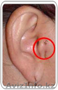 Минус лишние килло!! #1524799