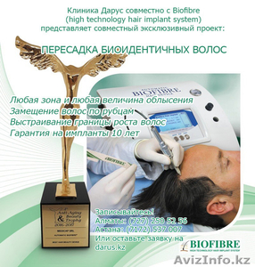 ПЕРЕСАДКА БИОИДЕНТИЧНЫХ ВОЛОС в Казахстане #1550943
