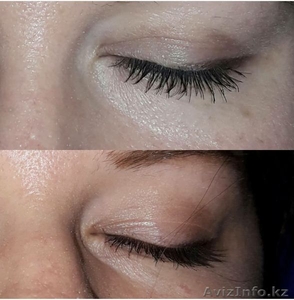 Бесплатная консультация по оздоровитльному ОМОЛОЖЕНИЮ. #1601318