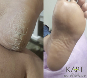 Подологический Центр КАРТ EFFECTIVE #1644128