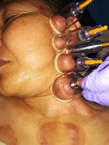 Семинар Юмейхо,  Хиджама и Висцеральный массаж #1646127