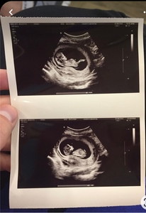 Клинике в Грузии нужны суррогатные матери! #1745069