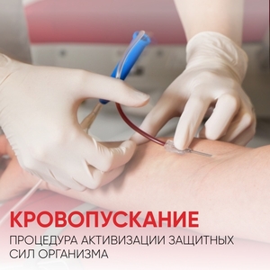 Гемоэксфузия для разжижения густой крови — прием ведет хирург   #1754194